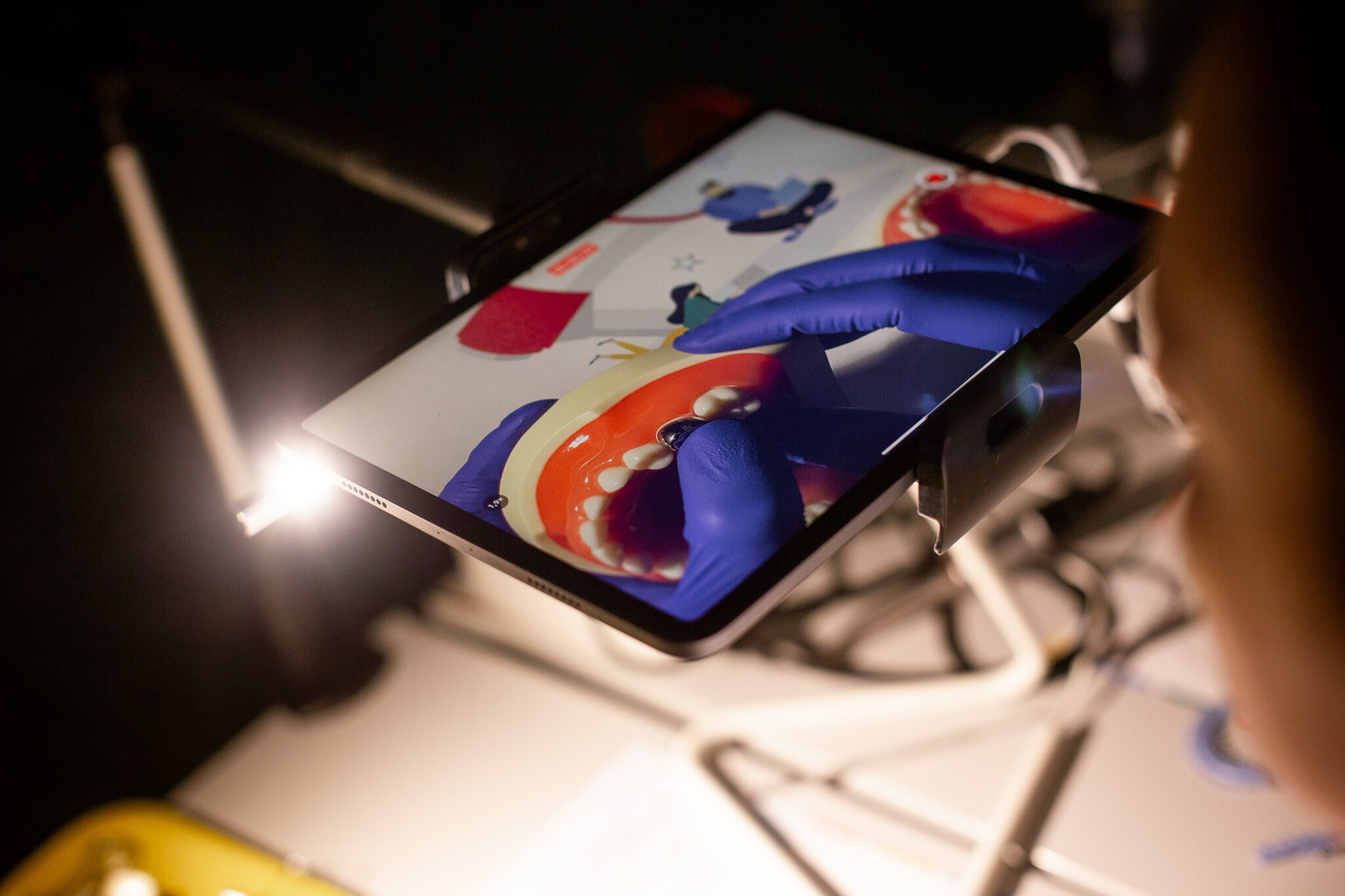 Pokaz na kursie dla dentystów z leczenia MIH