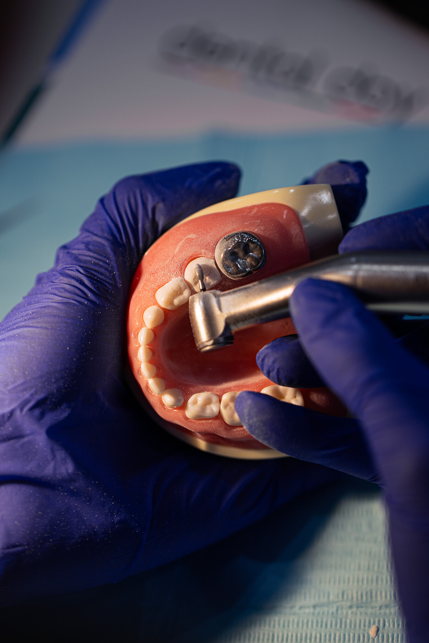 Szlifowanie pod korony stalowe