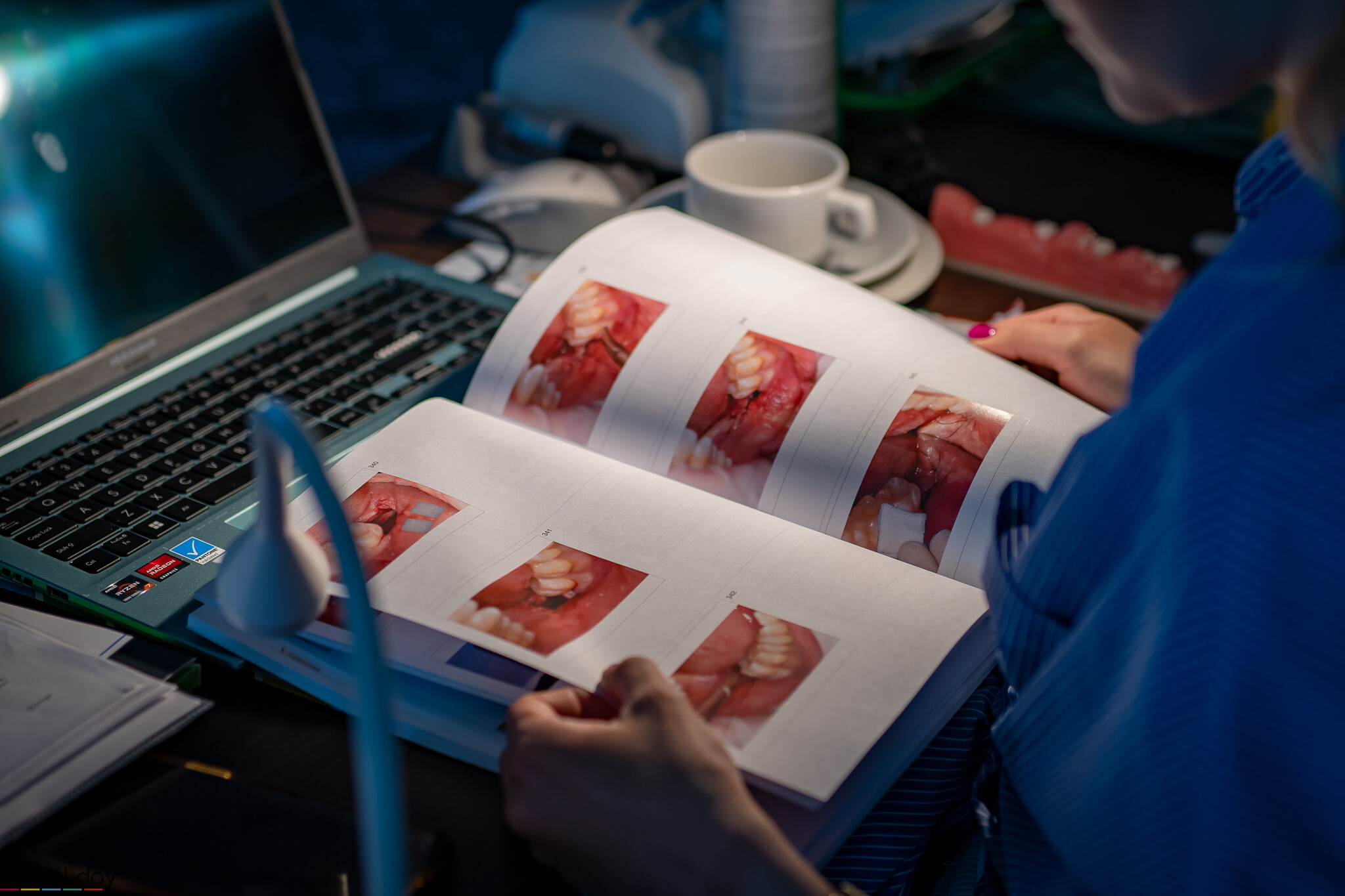 Kurs z chirurgii stomatologicznej - ekstrakcje zębów zatrzymanych