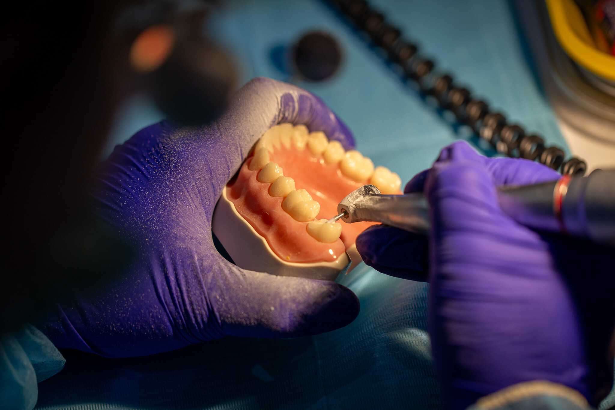 Szlifowanie pod nakład pośredni onlay