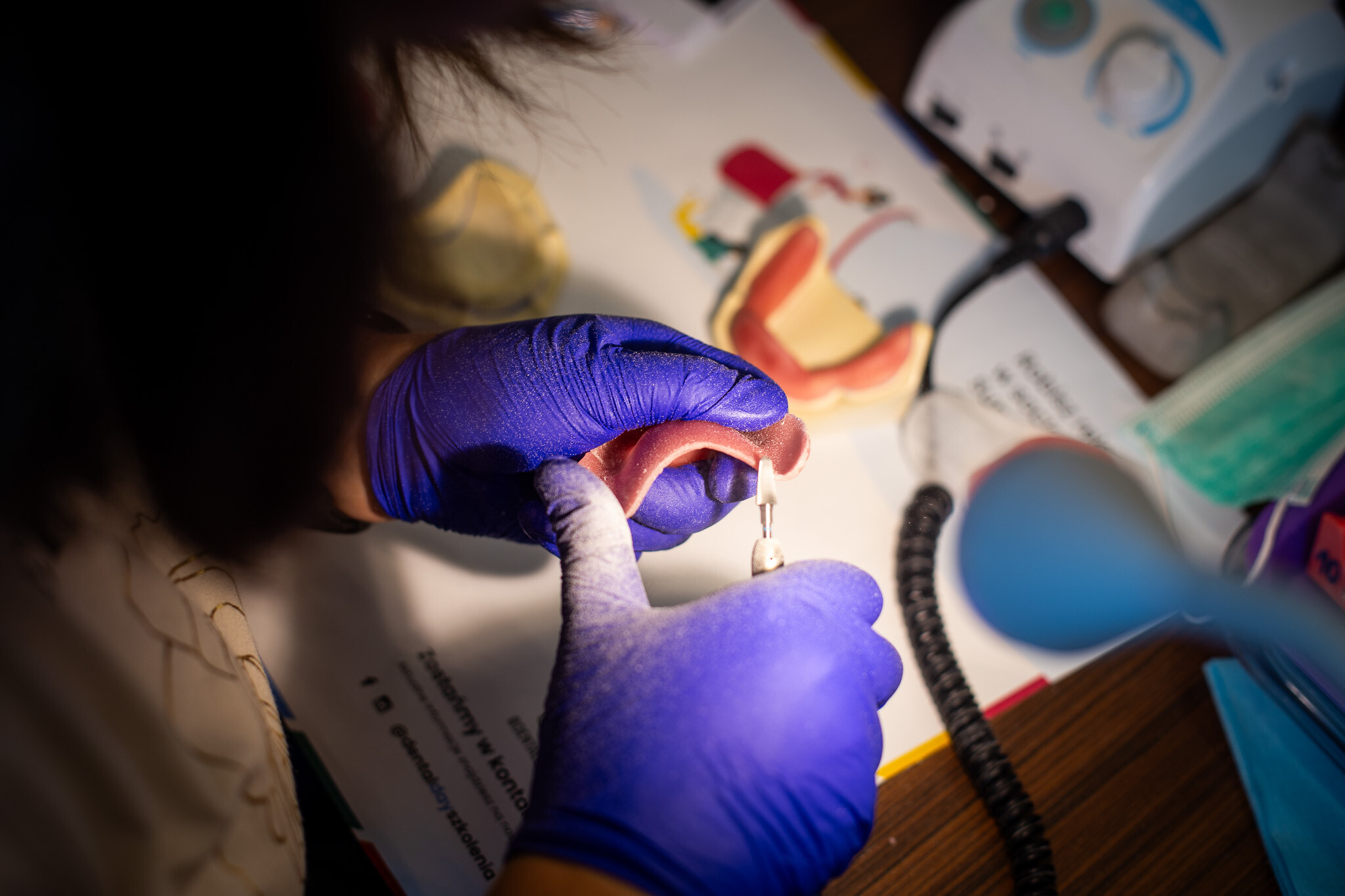 Wykonanie łyżek indywidualny - Dental Day