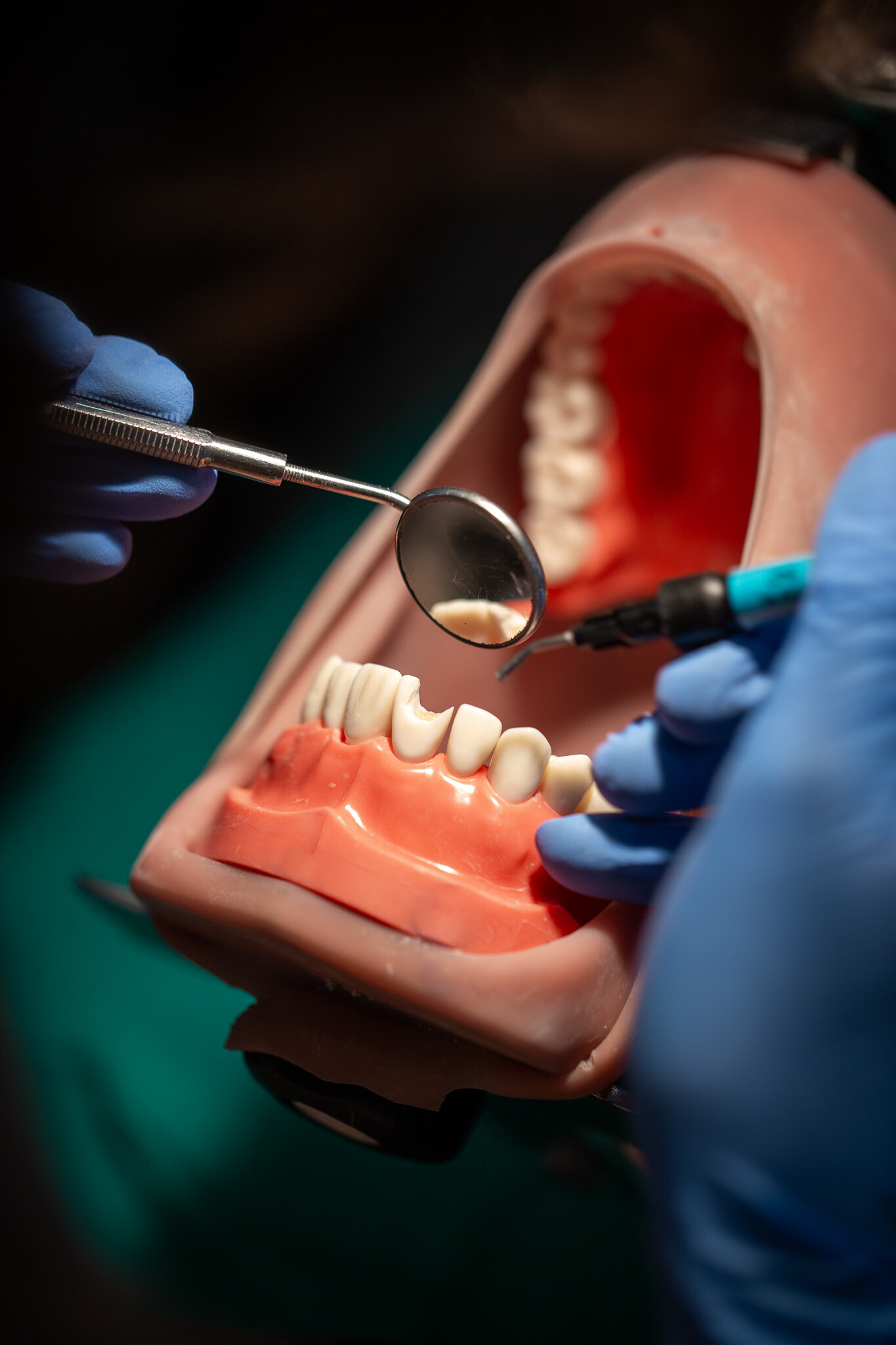 Urazy zębów - kurs z traumatologii zębów dzieci i dorosłych